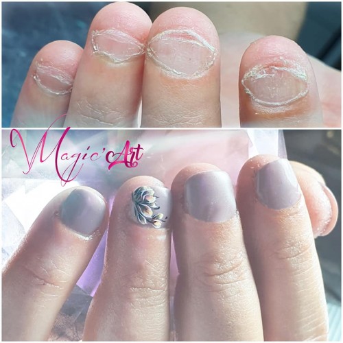 Formation - Ongles Rongés - Formations Online - Virginie Magic'art